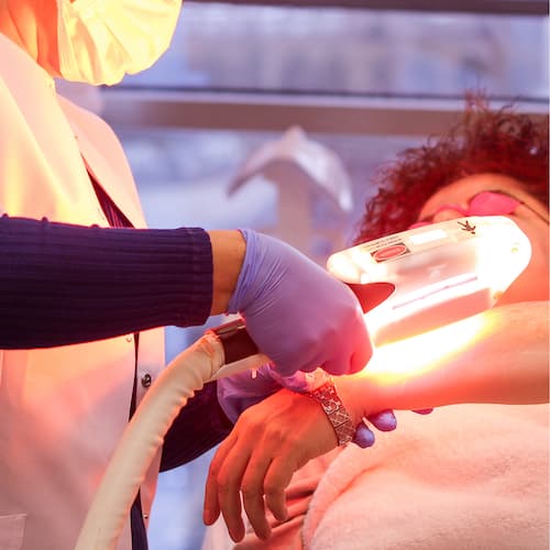 Sesión Láser en Bogota